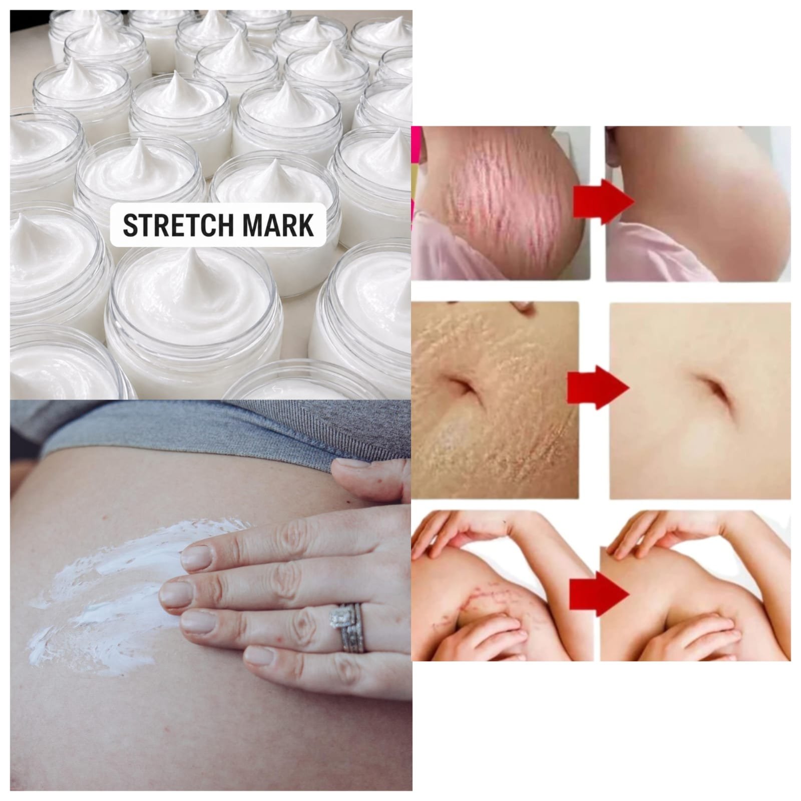 Stretch mark cream 10pc - Image 4