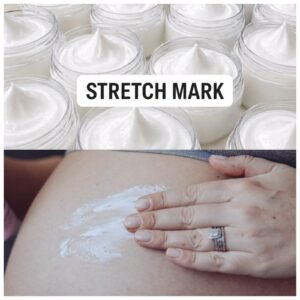 Stretch mark cream 10pc