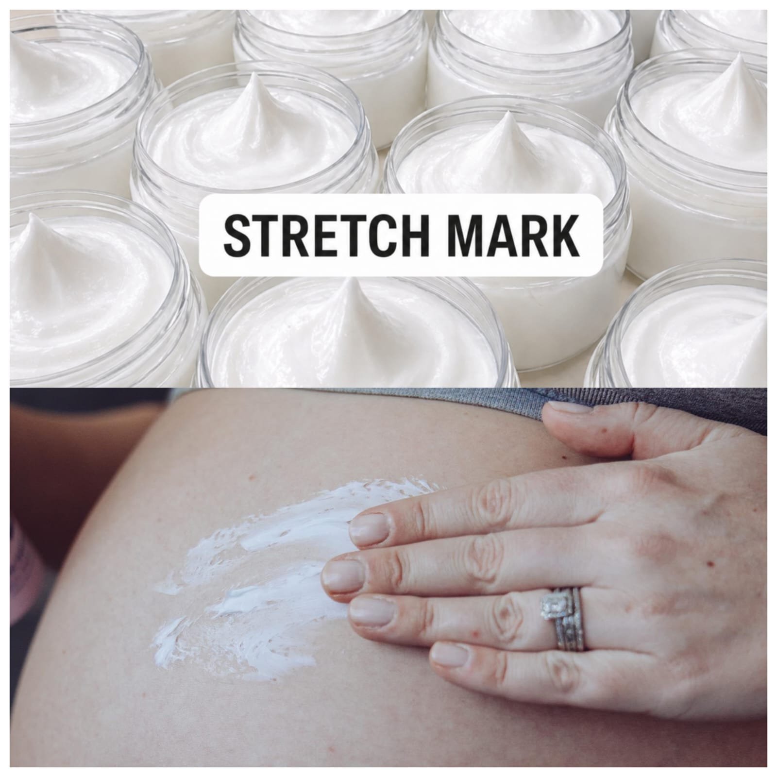 Stretch mark cream 10pc