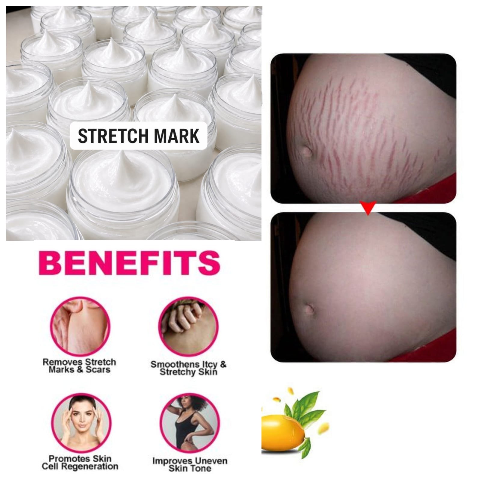 Stretch mark cream 10pc - Image 2